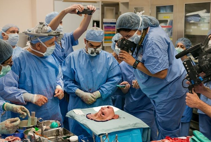 تصویر فوق العاده از عملیات پزشکی پیوند چهره انسان