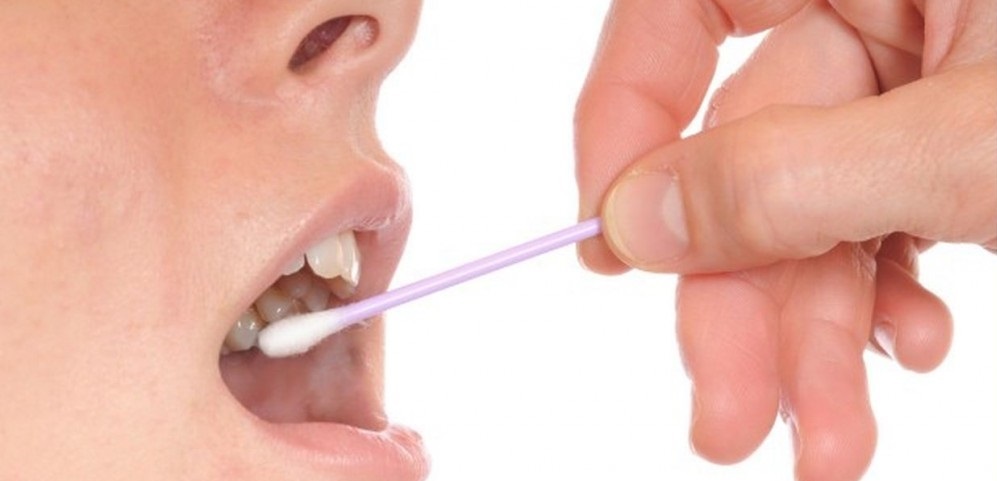 7 دلیل انباشت بیش از حد بزاق در دهان